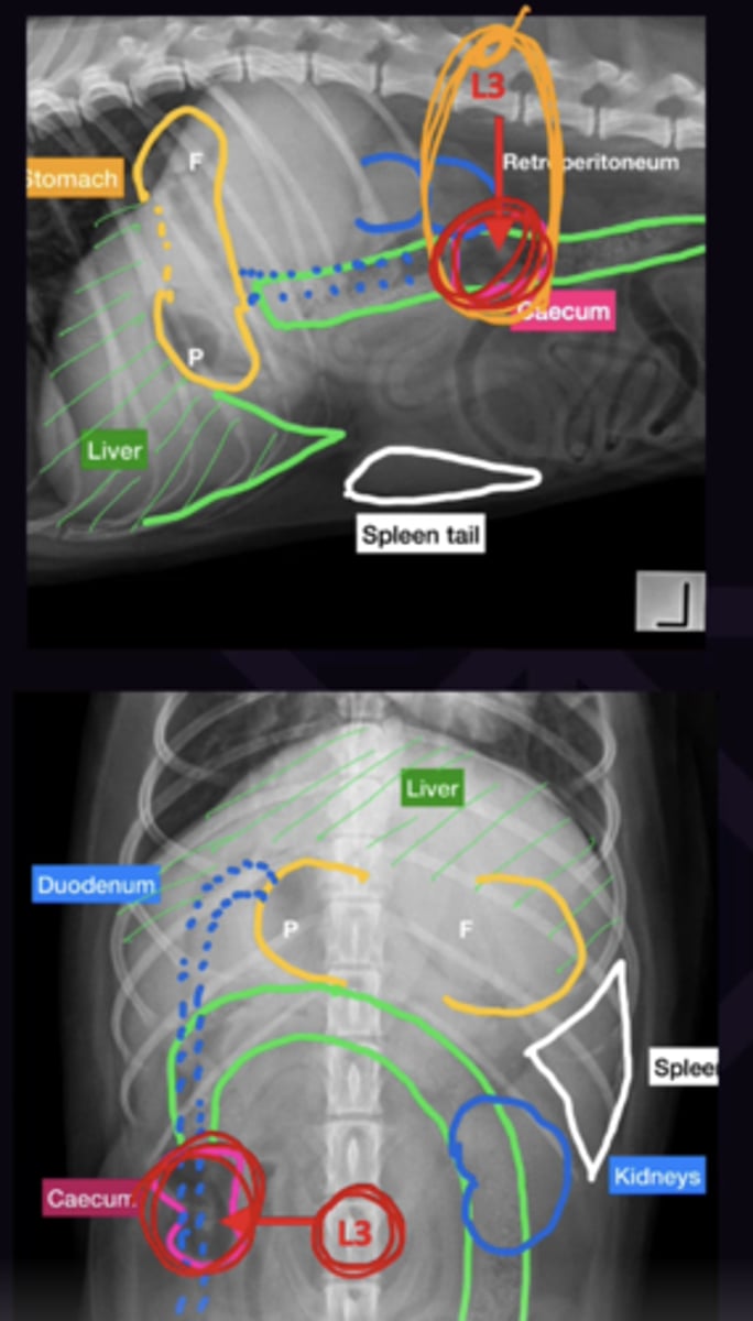 <p>1. Approx. level of L3 on both views</p><p>2. Large - not significant (Do not mistake for a segment of dilated small intestine)</p>
