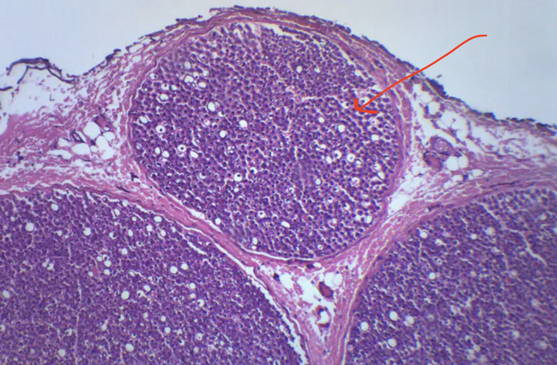 <p>What structure is shown (arrow)?</p>