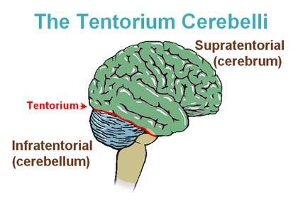 <p><mark data-color="unset" style="background-color: unset; color: inherit">a fold of the dura mater, a tough membrane lining the skull, that separates the cerebellum and brainstem from the cerebrum </mark></p>
