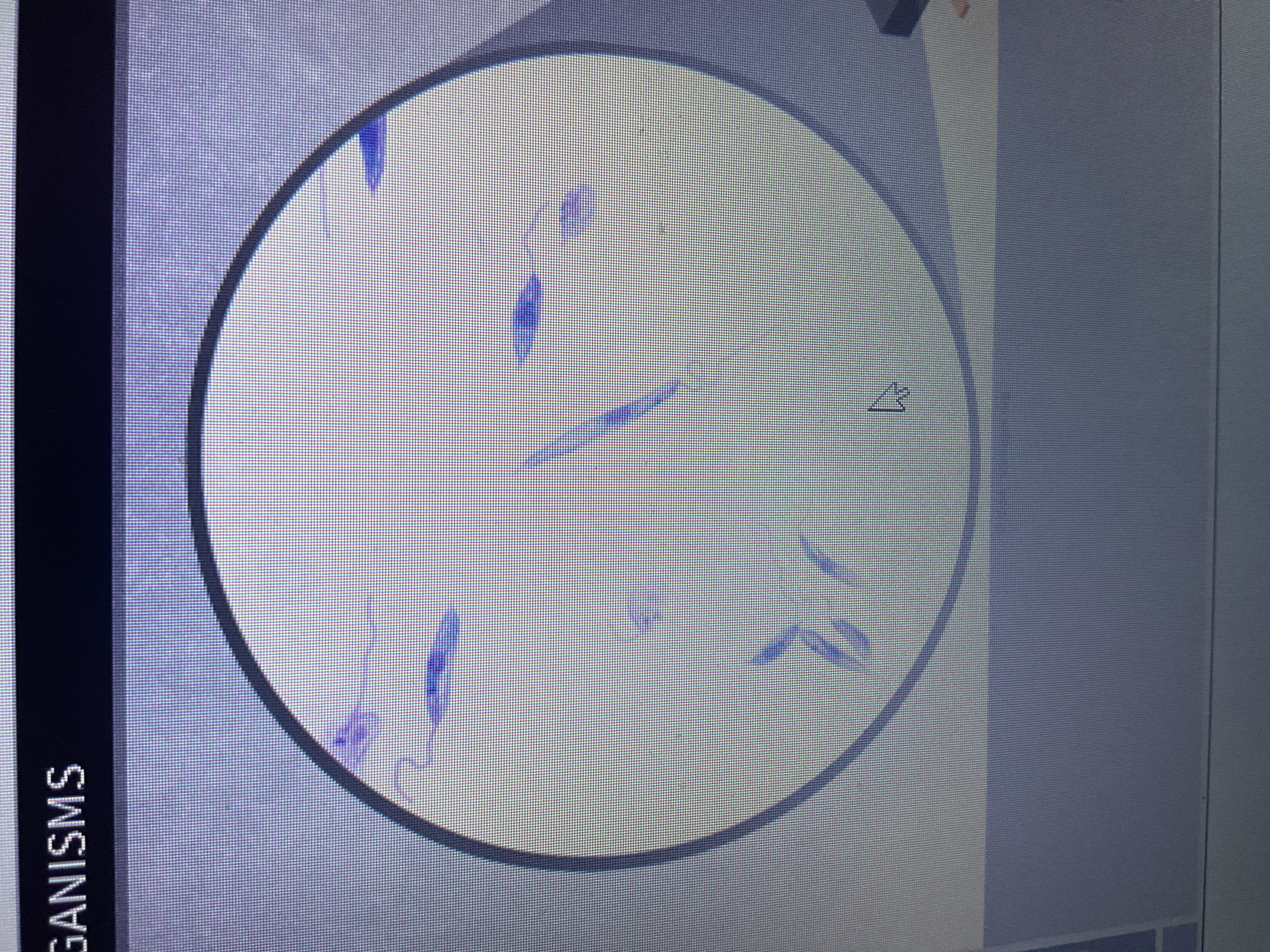 <p>Protozoa</p><p>sandfly transmission skin sores</p>