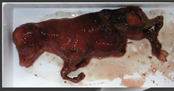 <p>abortions may be endemic or epidemic</p><p>-endemic: persistently elevated abortion rate of over 5%/year</p><p>-epidemic: high proportion of pregnant cattle abort over a relatively short period of time</p>