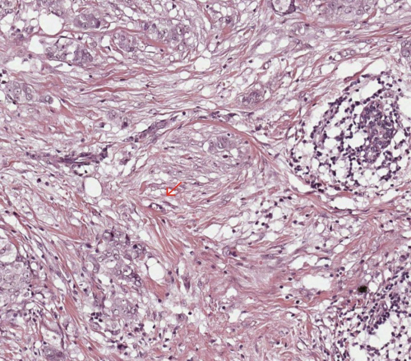 <p>Breast</p>