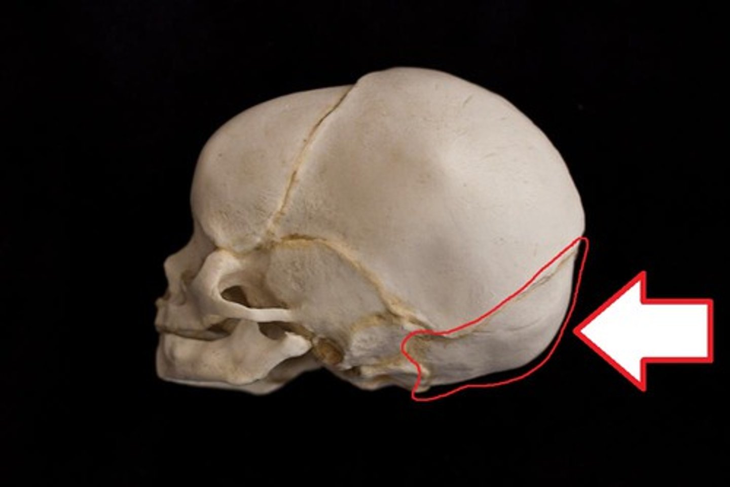<p>The occipital bone is set at the rear of the cranium and articulates with the temporals, sphenoid, parietals, and the uppermost vertebra, the atlas.</p><p>(Better pictures:</p><p>https://www.bartleby.com/107/31.html)</p>
