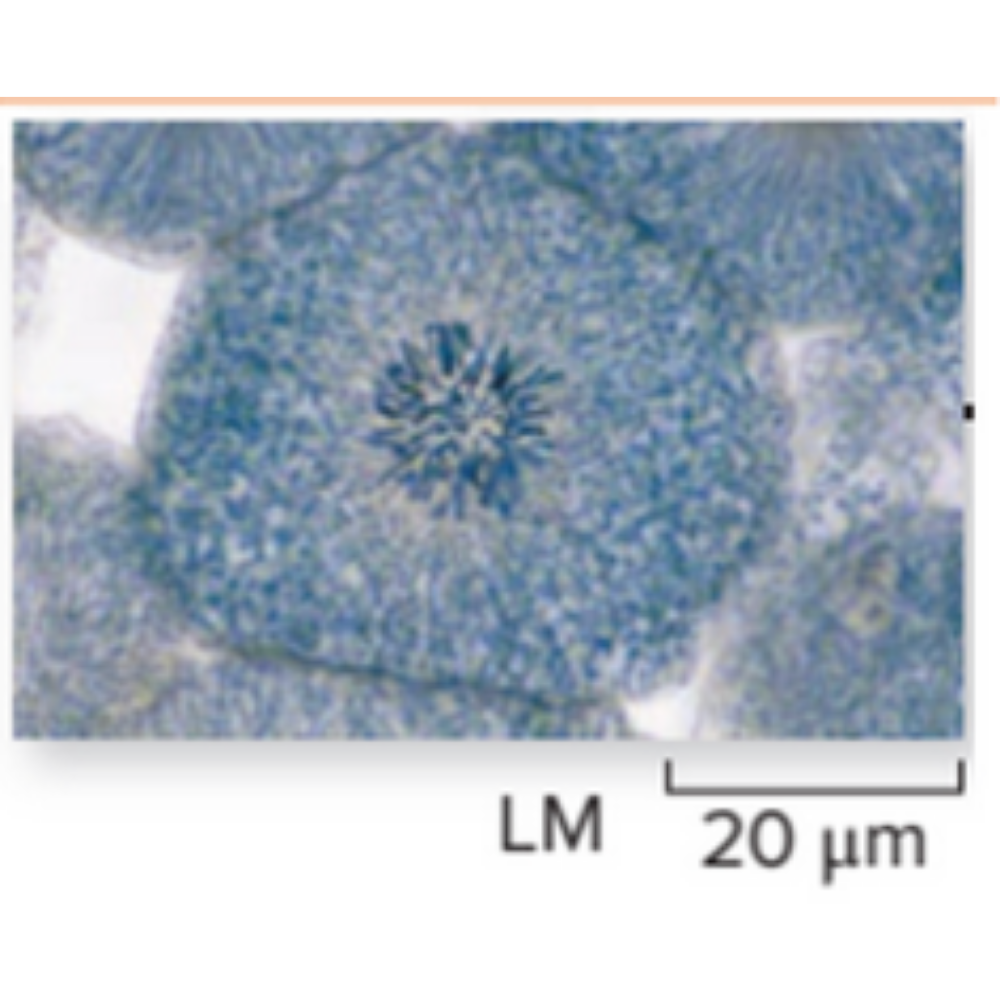 <p>What kind of cell is shown? Name the phase that it is experiencing.</p>