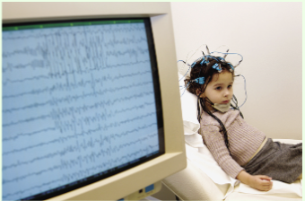 <p>What does an electroencephalogram (EEG) measure?</p>