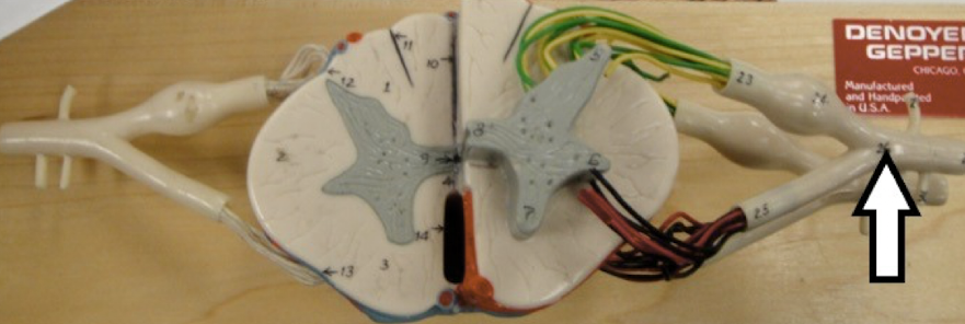 <p>identify the structure</p>