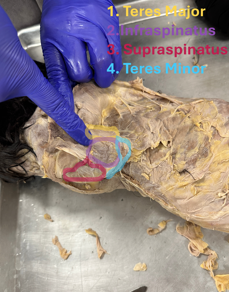 <p>Infraspinatus (i<strong>n-fra-spy-NAY-tus) (shoulder and bakc)</strong></p>