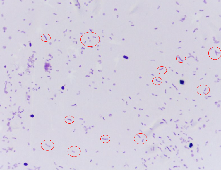<p>What bacteria is this?</p>