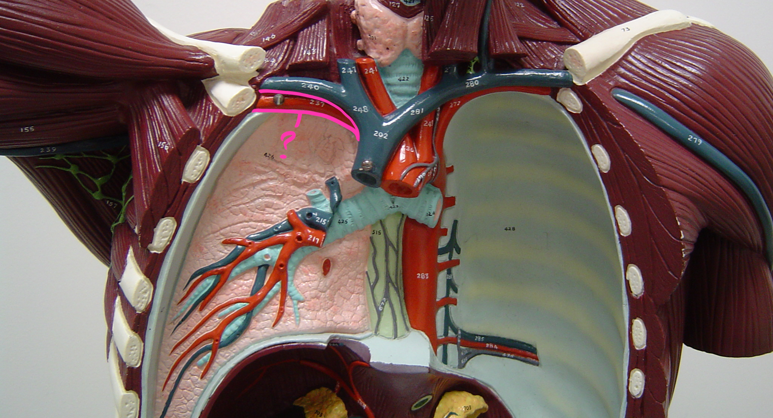 <p>what blood vessel is this? (in pink) (<span><span>supplies blood to the right shoulder and arm)</span></span></p>