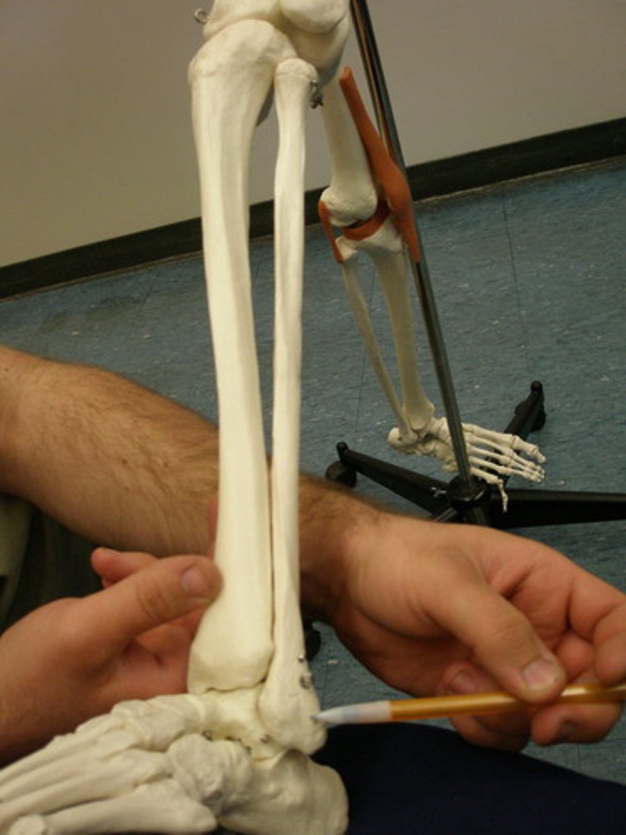 <p>A rounded bony prominence on either side of the ankle; also called the ankle bone.</p>