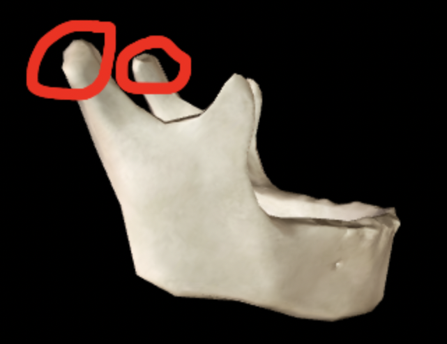 <p>What part of the mandible is this?</p>