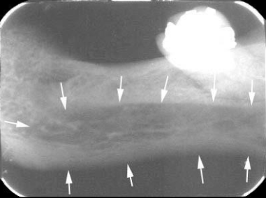 term image