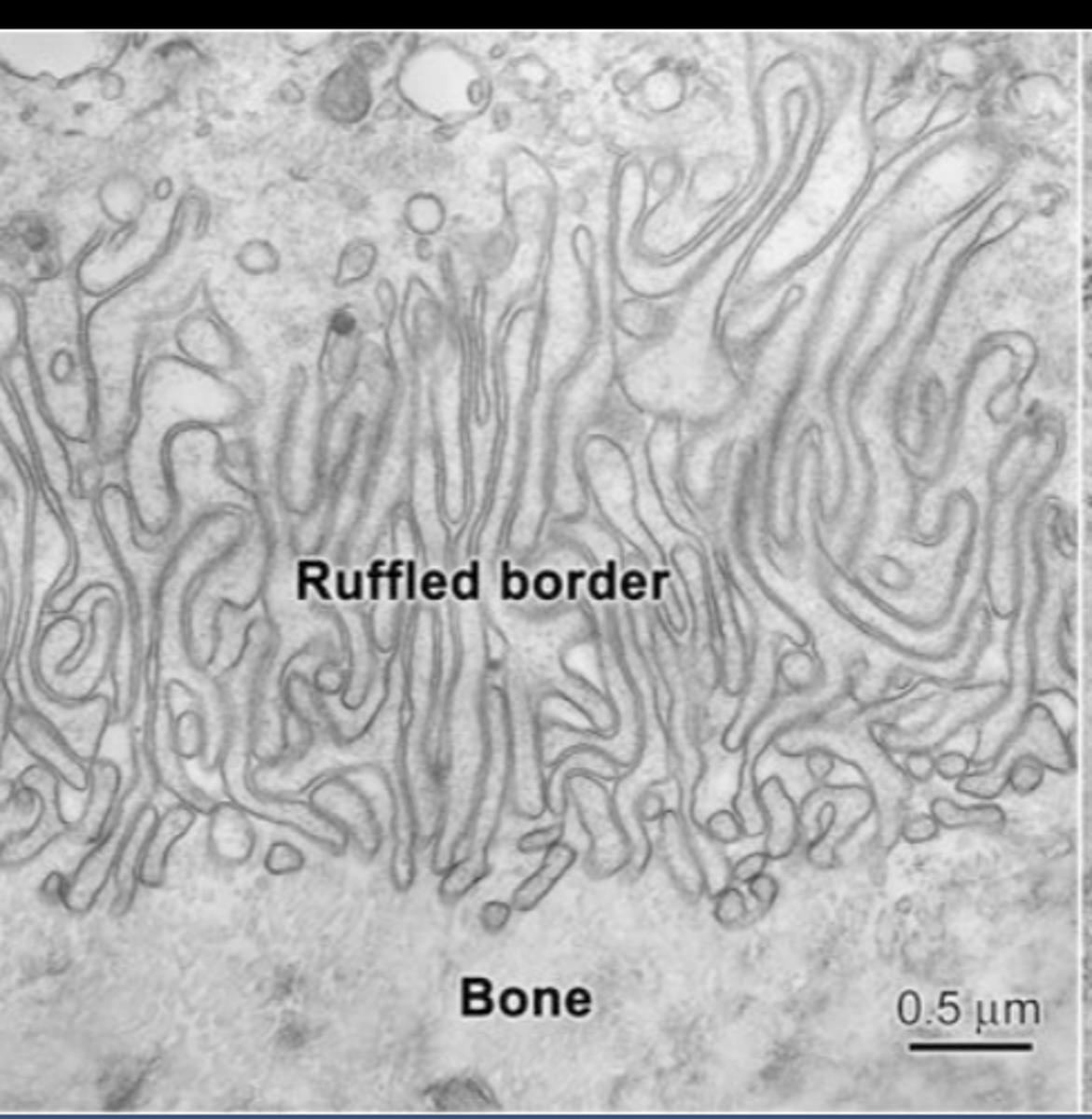<p>where cell membrane borders bone and resorption is taking place</p>