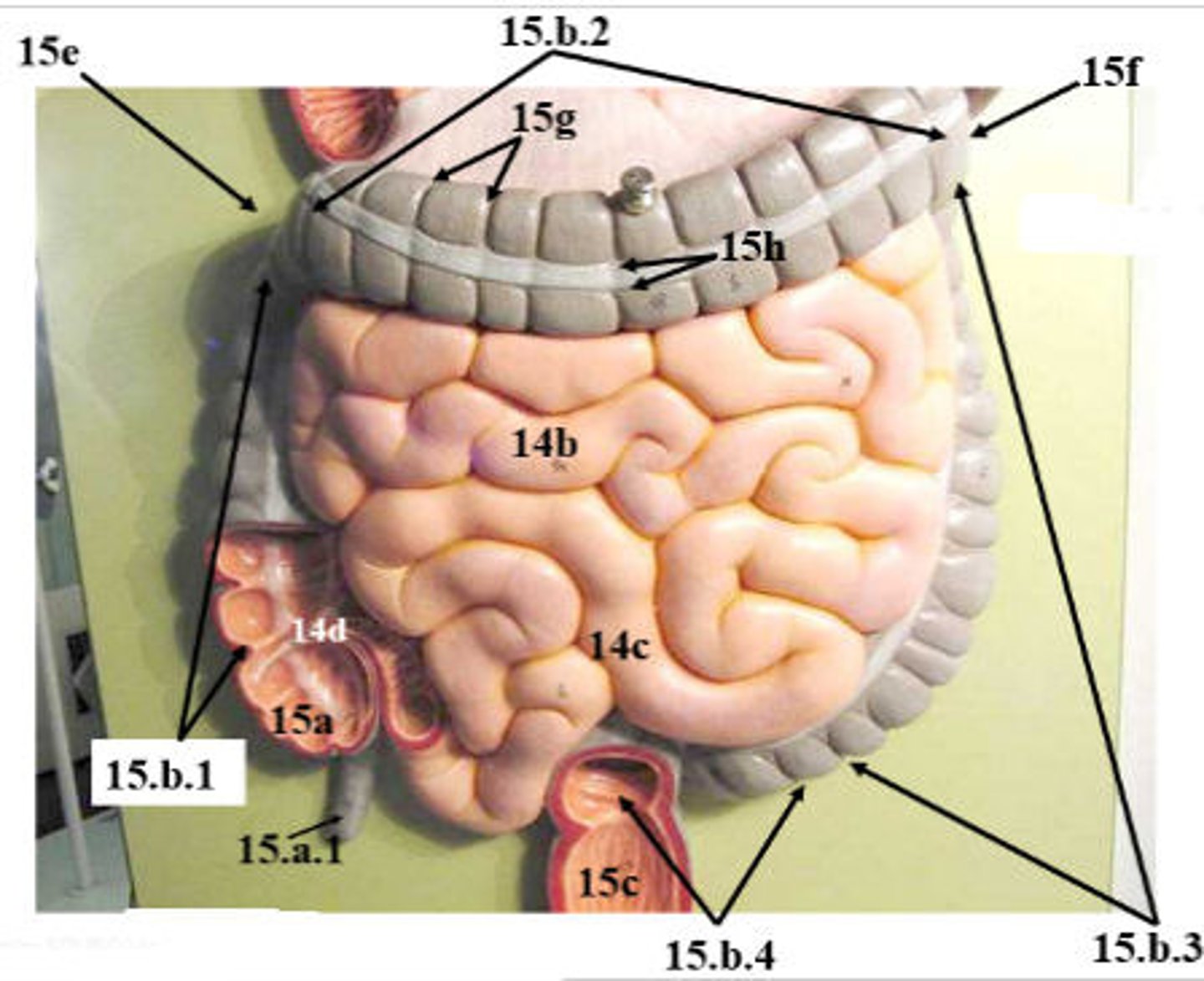 <p>What is 14b?</p>