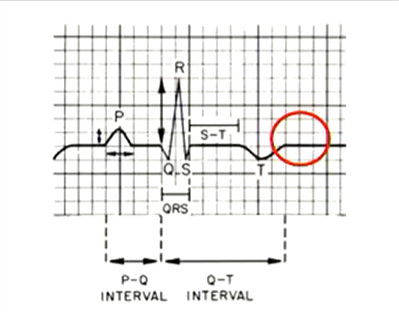 <p>What is happening here?</p>
