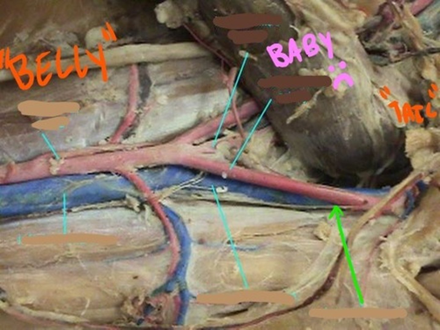 <p>identify this vein</p>