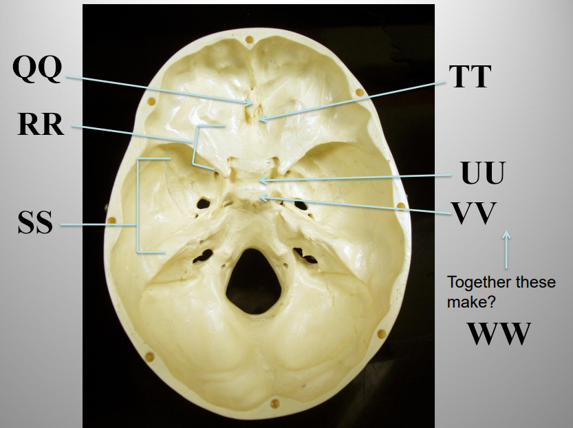 <p>What structure is letter UU?</p>