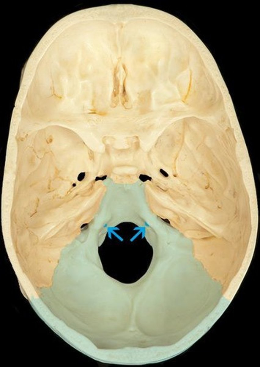 <p>Occipital bone</p>