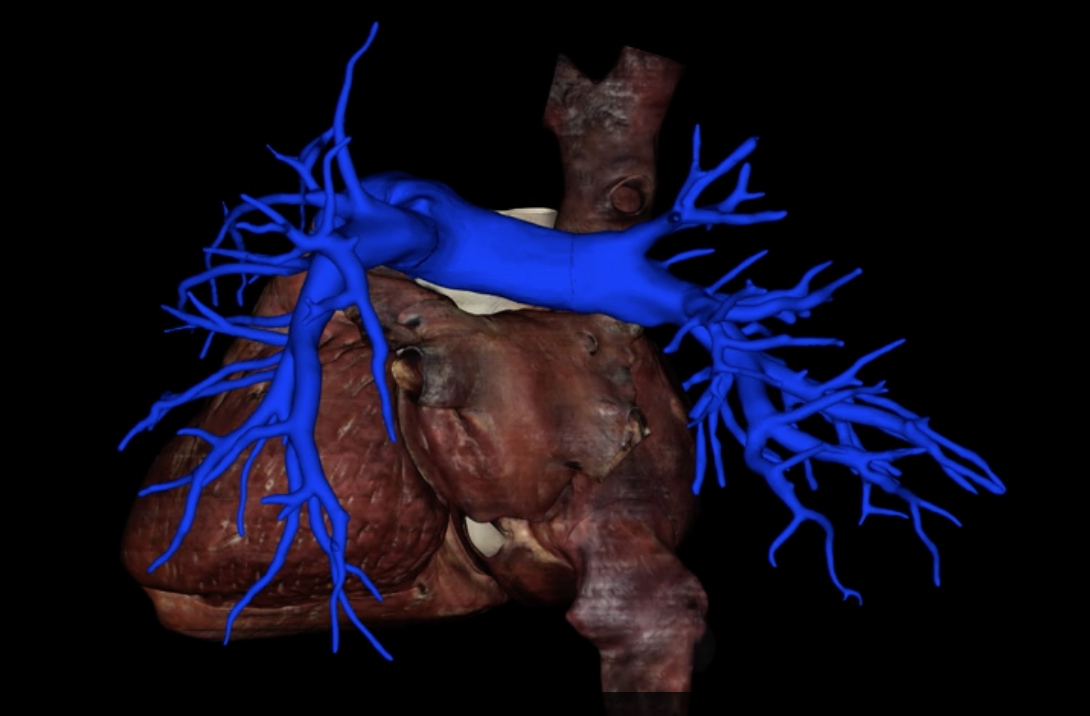 <p>What is highlighted in blue?</p>