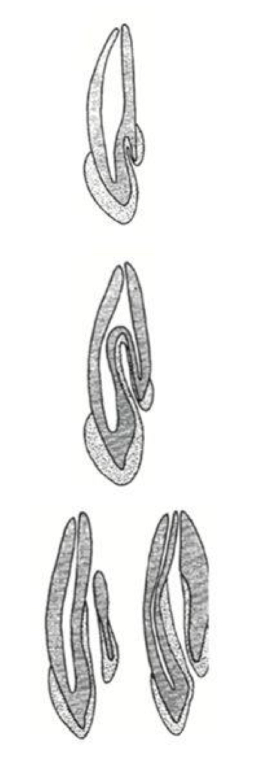 <p><span><span>What are the 3 types of dens invaginatus that are part of Oehlers classification?</span></span></p>