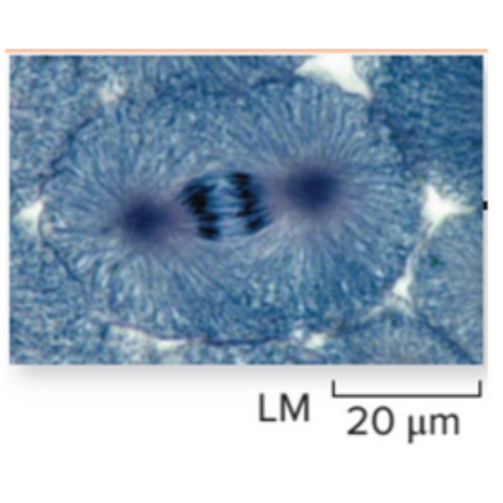 <p>What kind of cell is shown? Name the phase that it is experiencing.</p>