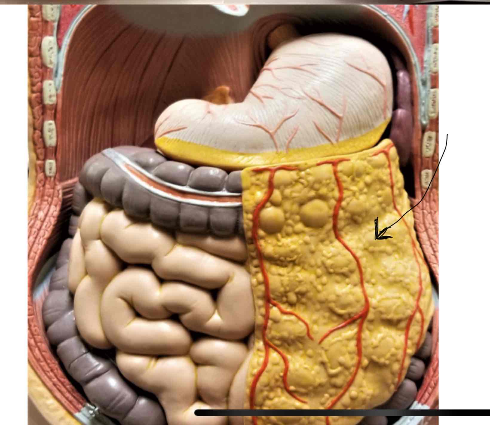 <p>Greater Omentum</p>