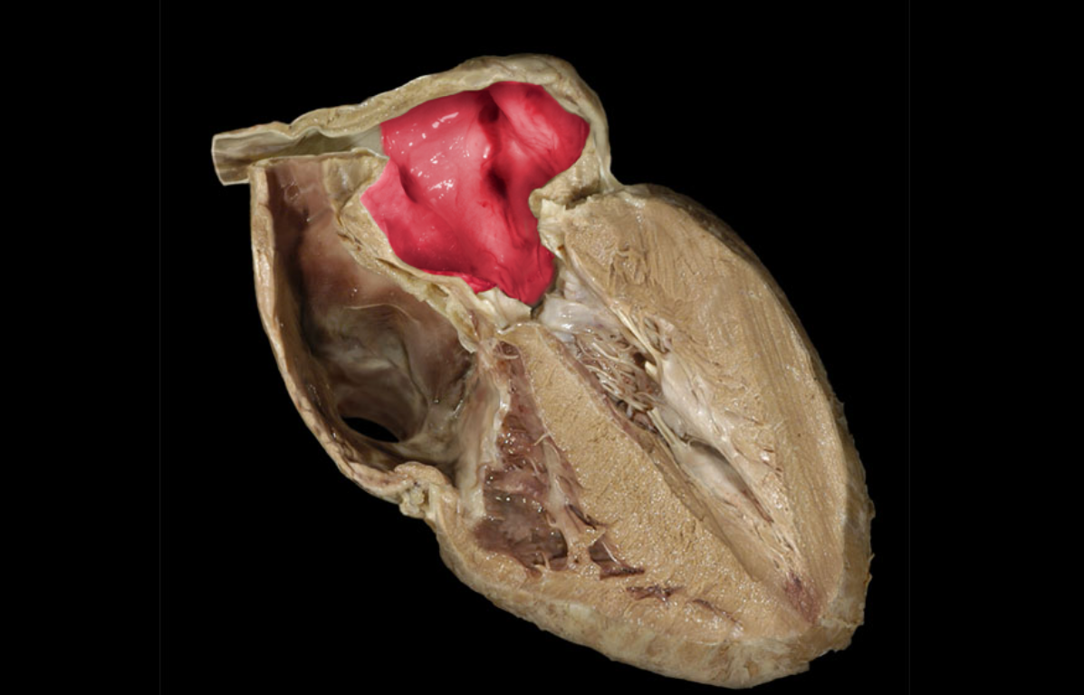 term image