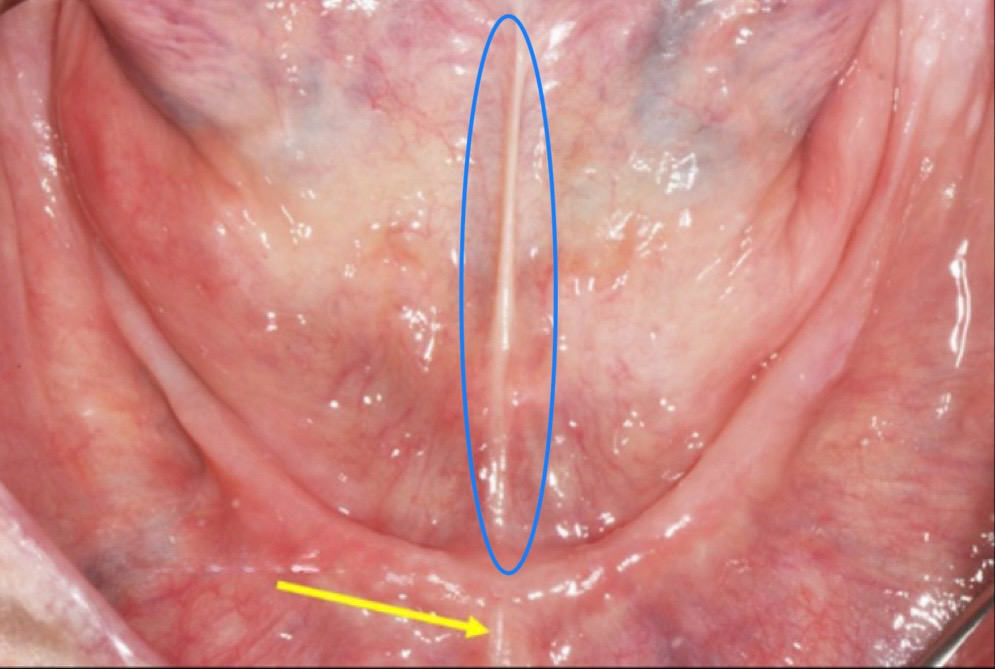 <p>what structure is circled in blue?</p>