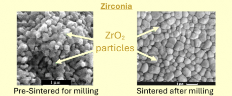 <p>Stable form of zirconia with the highest fracture resistance of all ceramics because they are durable and fatigue resistant</p><ul><li><p>Phase transformation: from tetragonal to monoclinic associated with 4-5% volumetric expansion</p></li><li><p>Fabrication thru sintering, gets 25-30% shrinkage</p></li><li><p>Used for everything; crowns, bridges, implants, abutments</p></li><li><p>Very tough but ofc no as tough as metals, and do not produce significant wear on opposing natural teeth</p></li></ul><p></p><p>Monolithic zirconia: the entire crown is zirconia. eliminates problem where veneering porcelain layer would fracture</p><ul><li><p>Disadvantage is that it has very limited optical properties, they are also hard to adjust due to complete crystallinity after sintering</p></li><li><p>Most popular in the US</p></li></ul><p>High Translucency zirconia: mix of cubed (transparent) and tetragonal zirconia; improved esthetics but decreased fracture strength</p><ul><li><p>Must me 0.5mm or less, no sharp angles</p></li></ul><p></p>
