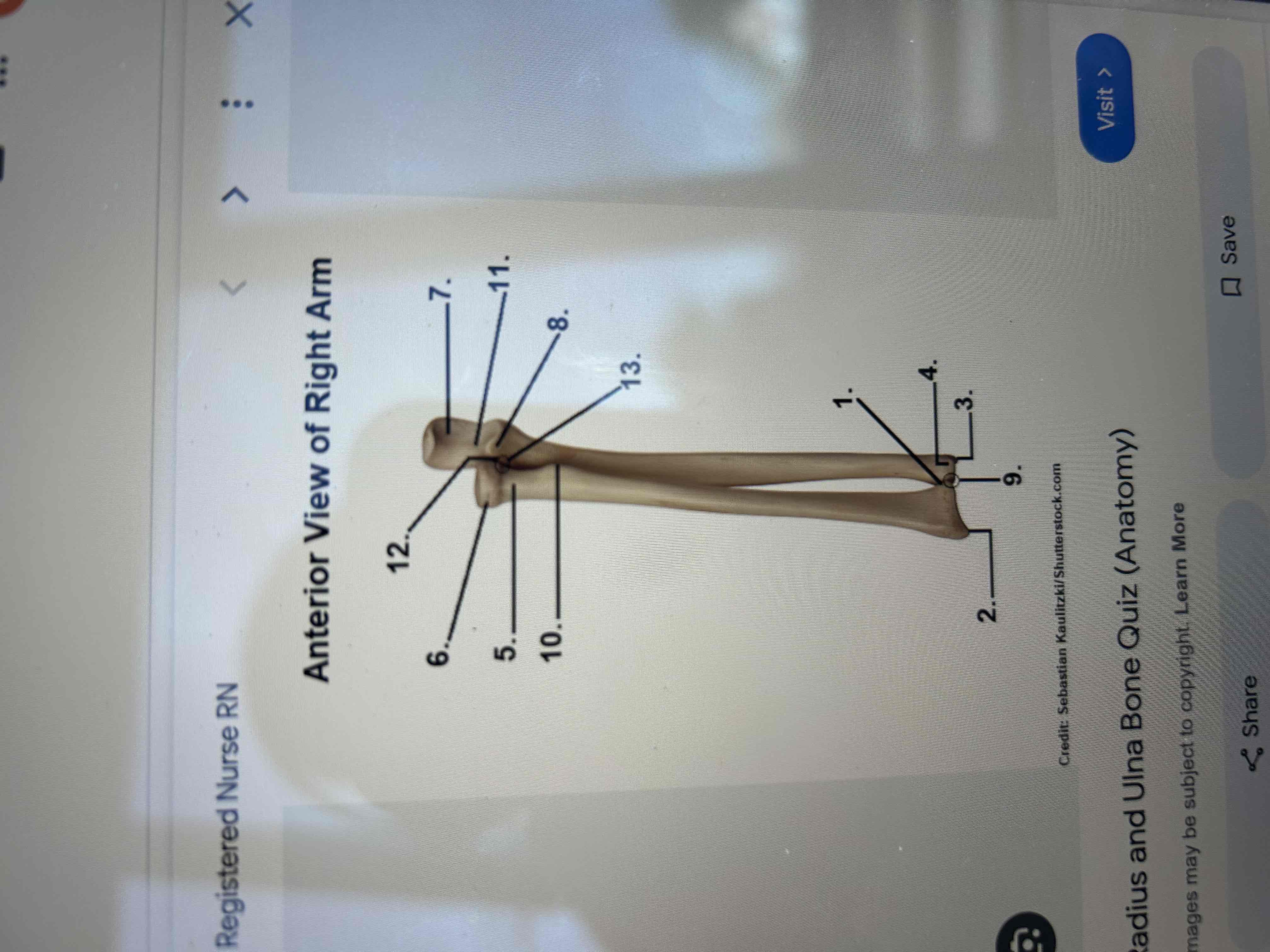 <p>Identify 11 &amp;3 of the ulna</p><p>6&amp;2 of the radius </p>