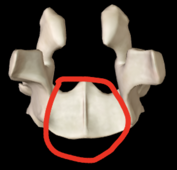 <p>What part of the palatine is this?</p>