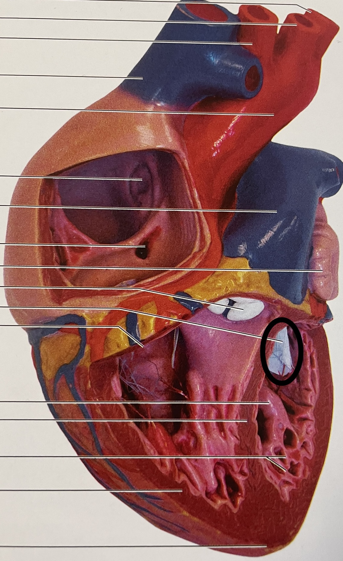 left atrium to left ventricle