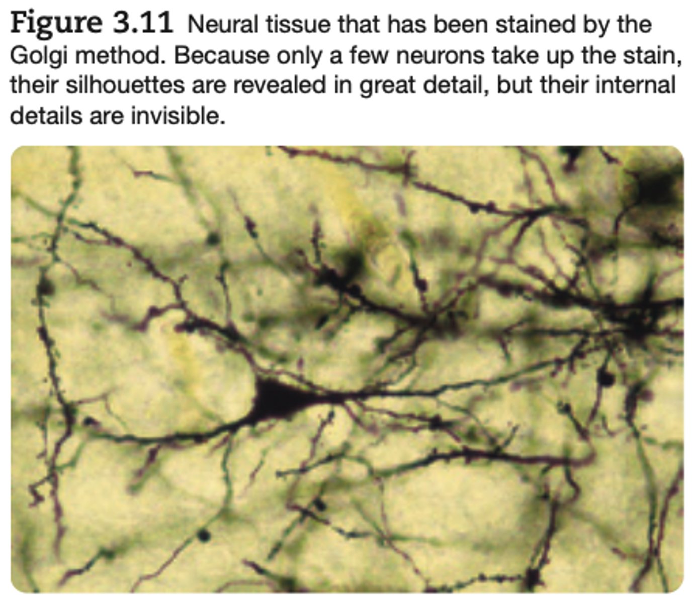 <p>Golgi stains are commonly used to discover the overall shape of neurons.</p>