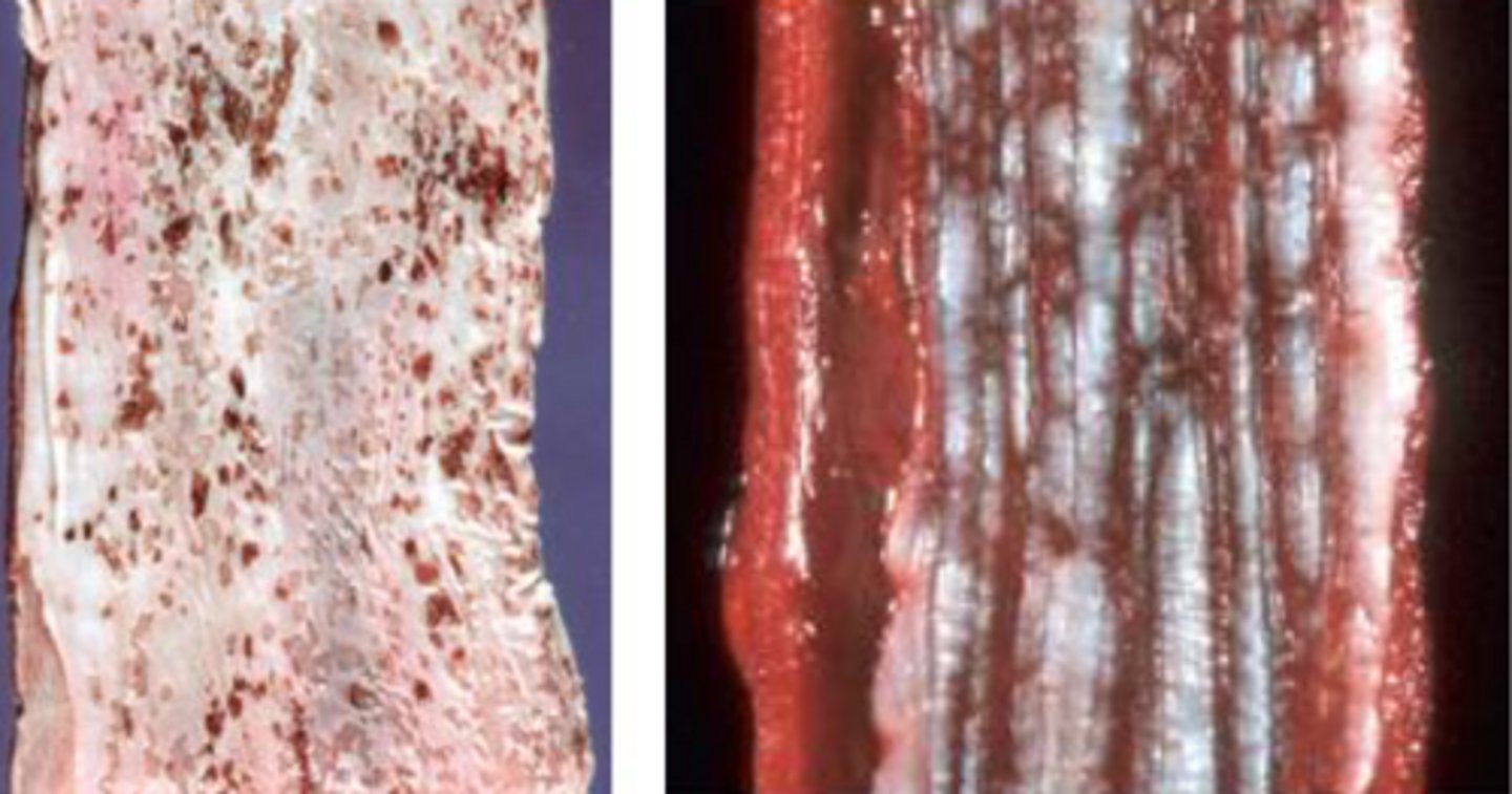 <p>What are causes of ulcerative esophagitis?</p>