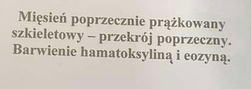 <p>położonie peryferycznie jąfrza aby reszta była zajęta przez aktynę i miozynę</p>