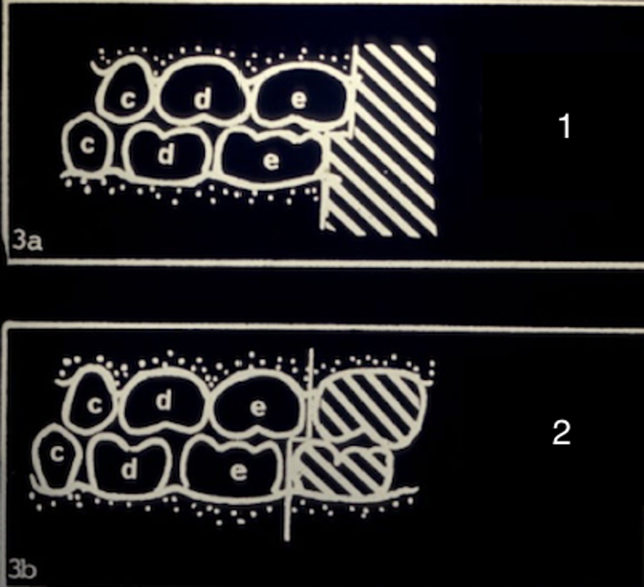 <p>The permanent dentition are in what relationship (2)?</p>