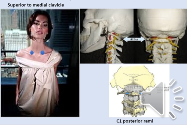 <p>anterior point: superior to medial clavicles<br>posterior point: C1 posterior rami</p>