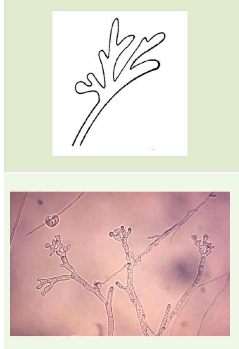 <p>Name this hyphae</p>