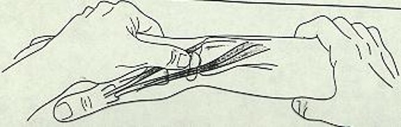 \-Contents → Scaphoid Bone

\-Radial Border → EPB tendon & Abd. PB tendon

\-Ulnar Border → EPL tendon

(PIC: Bottom → EPB tendon, Middle → Abd. PB tendon, Top → EPL tendon