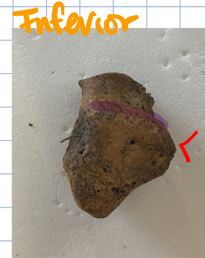 <p>What is red arrow?</p>