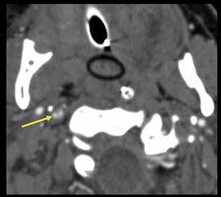 <p><span style="color: blue;"><strong>Que regarde-t-on ?</strong></span></p>