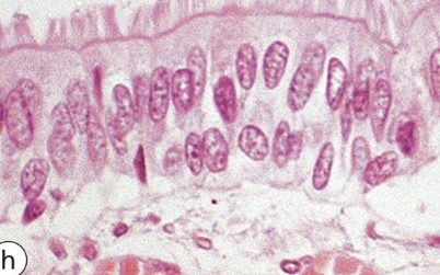 <p>what type of epithelium is shown here</p>