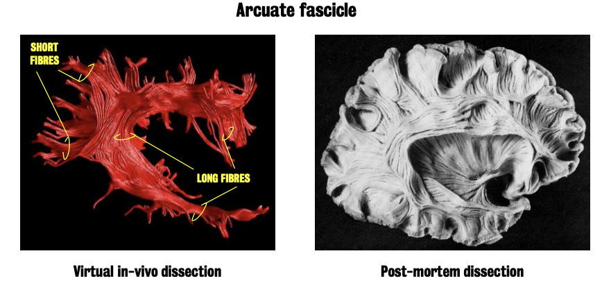 Tractography reconstruction
