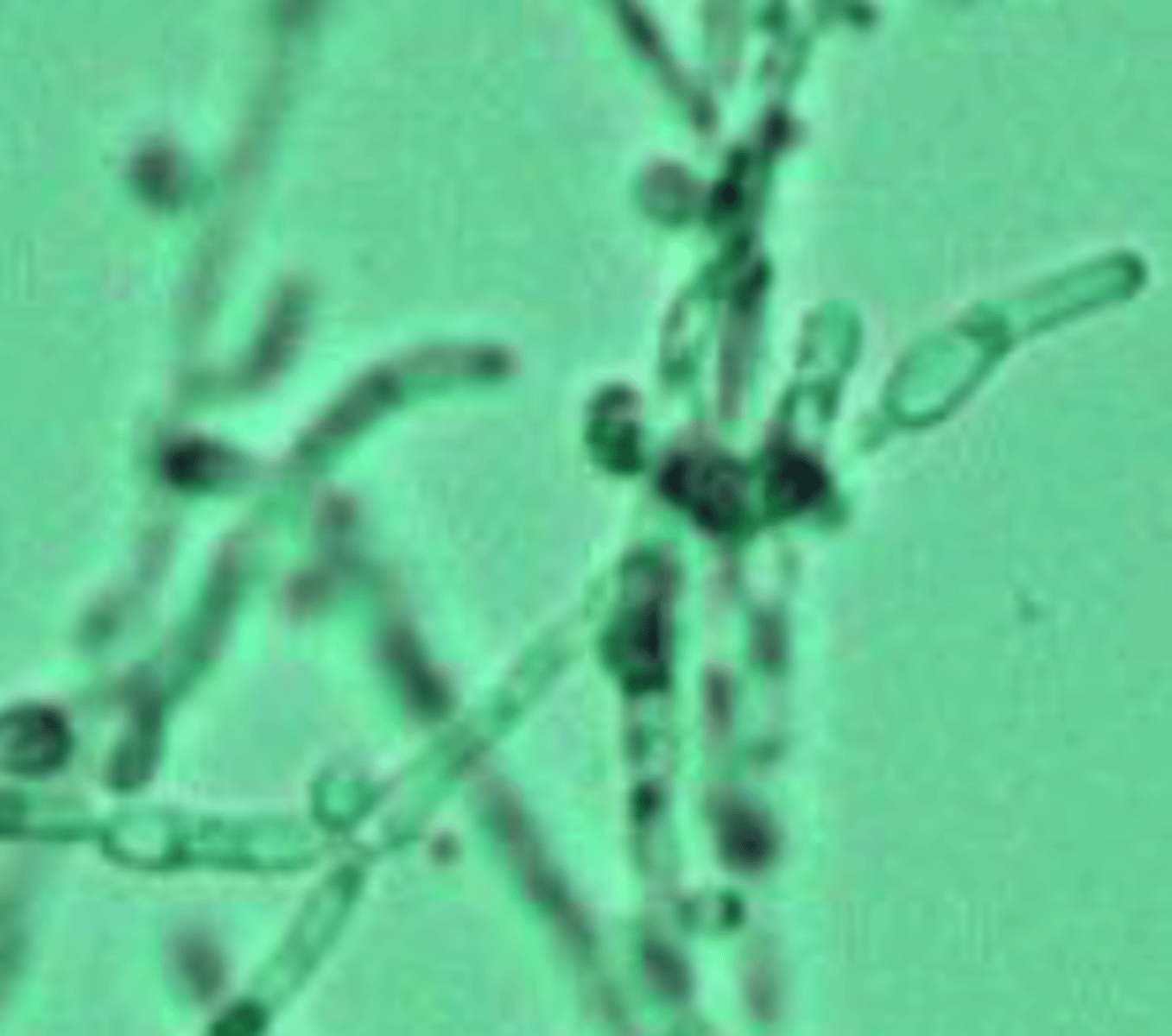 <p>- Rare</p><p>- Colorless, oval, double refractile walls</p><p>- Often confused with RBCs or lipids</p><p>- Caused by contamination</p>