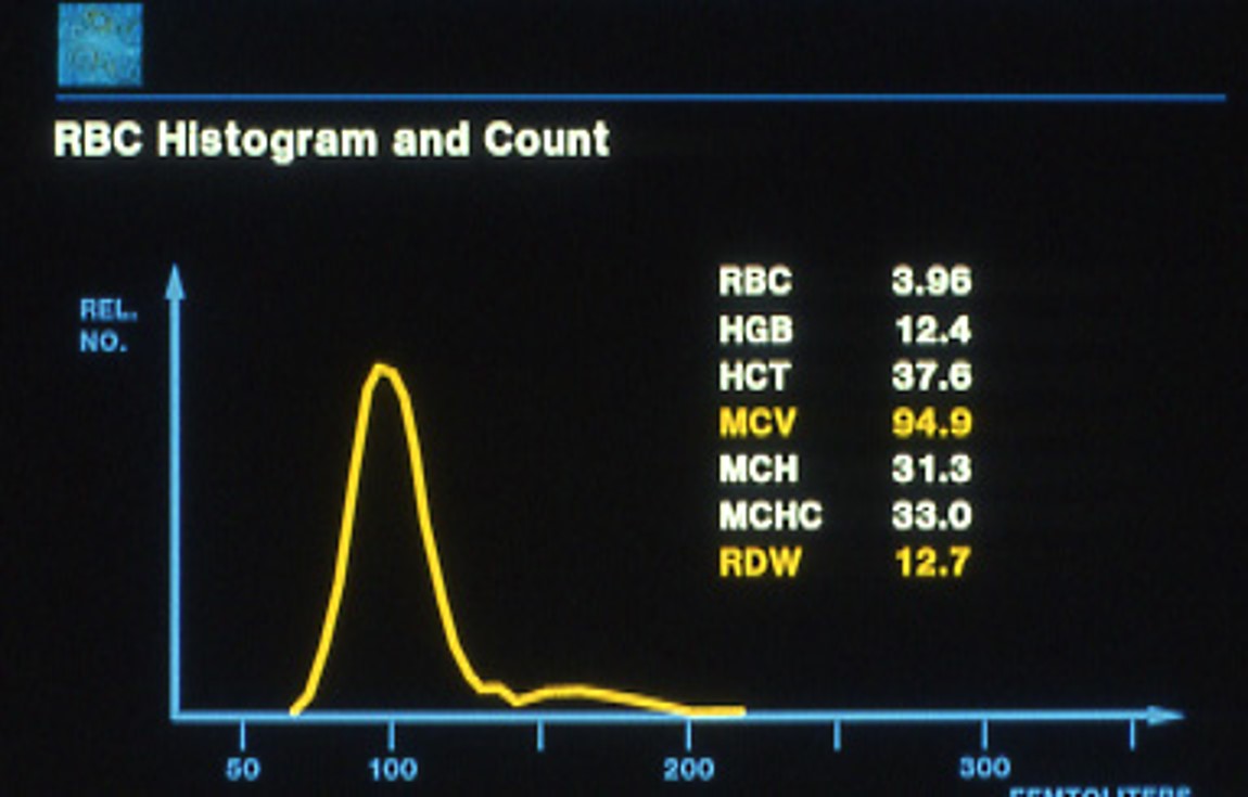 What would a second bump at the 150 mark mean