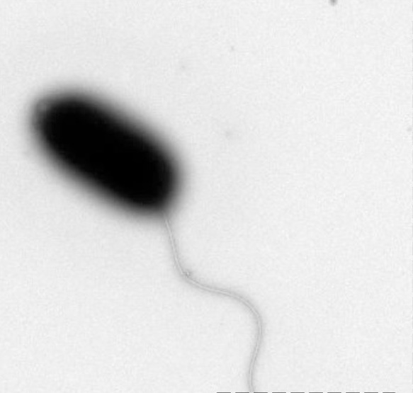 <p><span>The micrograph below depicts a bacterium with a/an _______________&nbsp; arrangement of flagella.</span></p><p>monotrichous</p><p>peritrichous</p><p>&nbsp;lophotrichous</p><p>&nbsp;amphitrichous</p>