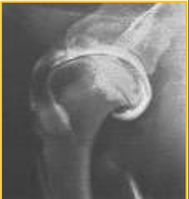<p>Arthrography - preferred contrast </p>