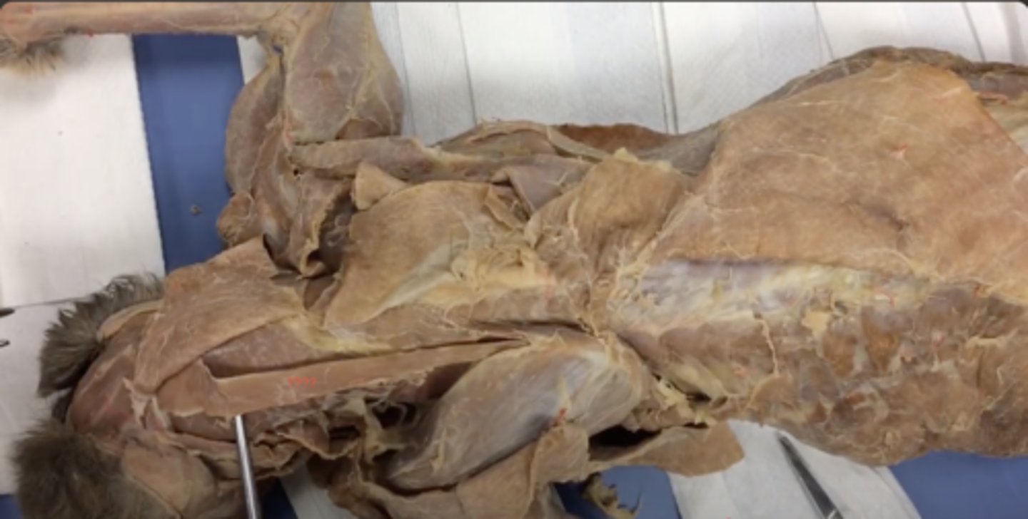 <p>name this muscle</p>