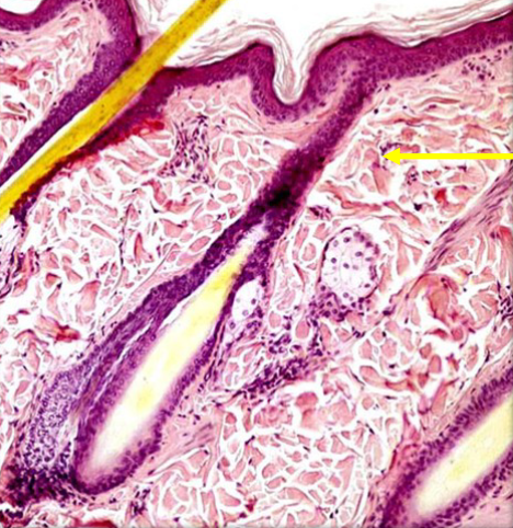 <p>The layer of skin located beneath the epidermis, consisting of connective tissue that provides strength and elasticity, containing blood vessels, nerves, and hair follicles. </p>