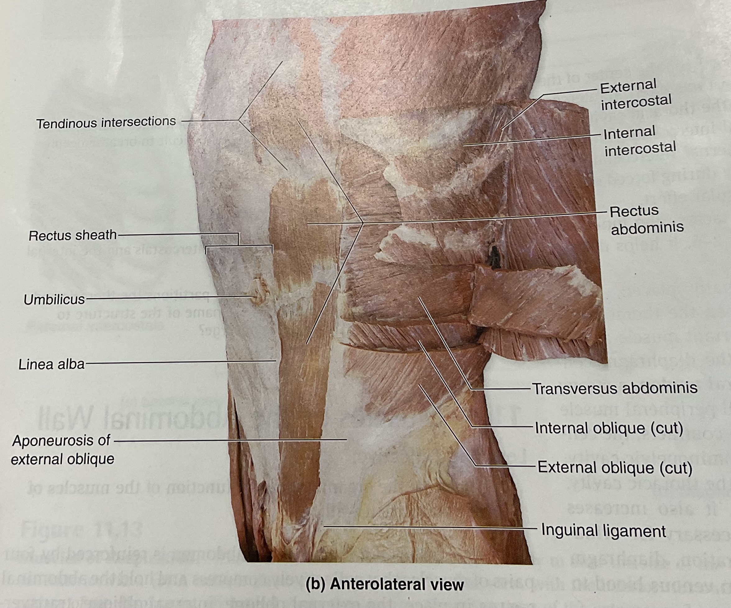 <p>Action:Compress abdomen Deep</p><p>Deepest of the 3 muscle sheets; fibers connect horizontally </p>